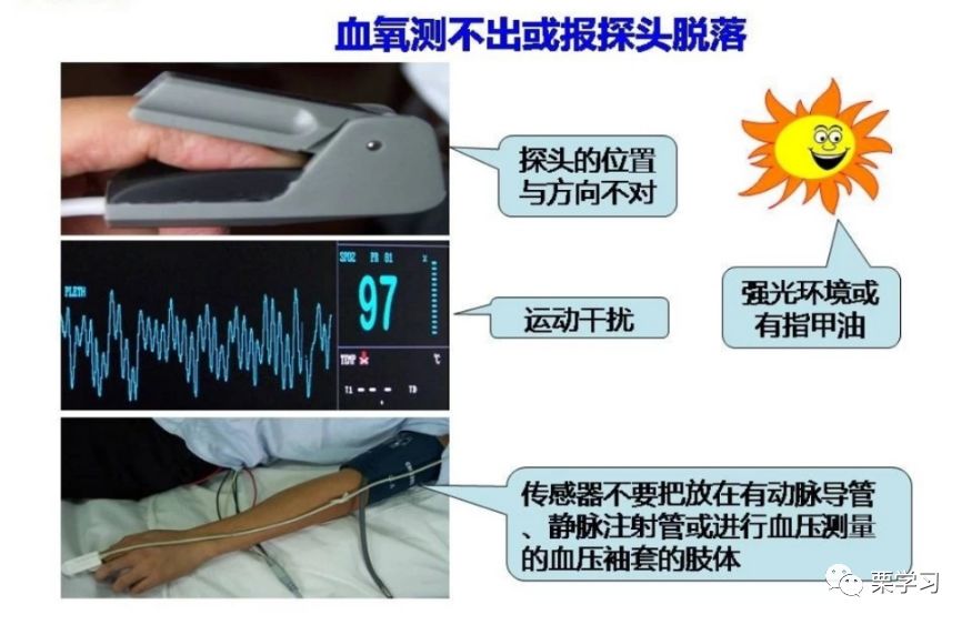 病人监护仪怎么用监护仪日常使用技巧_https://www.jmylbn.com_新闻资讯_第5张