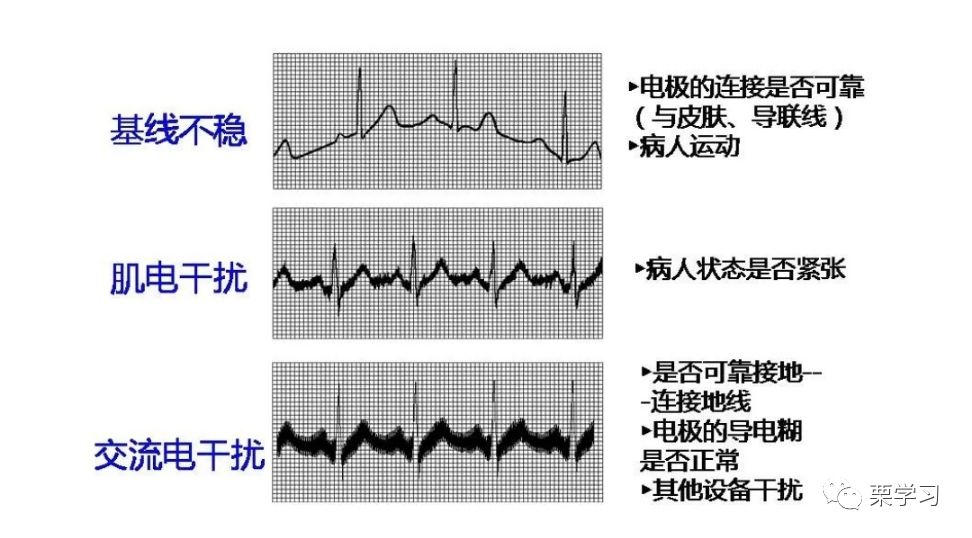 病人监护仪怎么用监护仪日常使用技巧_https://www.jmylbn.com_新闻资讯_第1张
