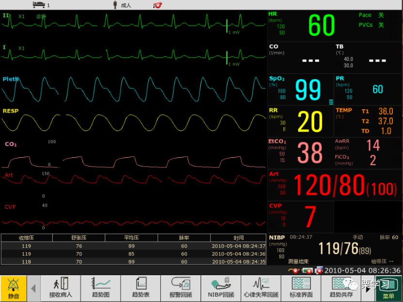 病人监护仪怎么用监护仪日常使用技巧_https://www.jmylbn.com_新闻资讯_第2张