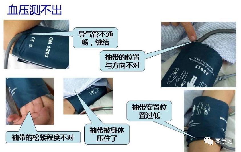 病人监护仪怎么用监护仪日常使用技巧_https://www.jmylbn.com_新闻资讯_第4张