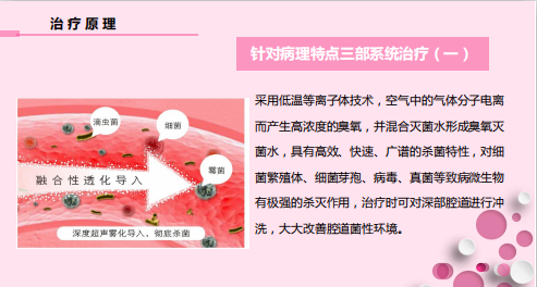 怎么销售透化治疗系统守护女性健康——SLOT妇科深度透化治疗系统_https://www.jmylbn.com_新闻资讯_第6张