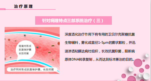 怎么销售透化治疗系统守护女性健康——SLOT妇科深度透化治疗系统_https://www.jmylbn.com_新闻资讯_第8张