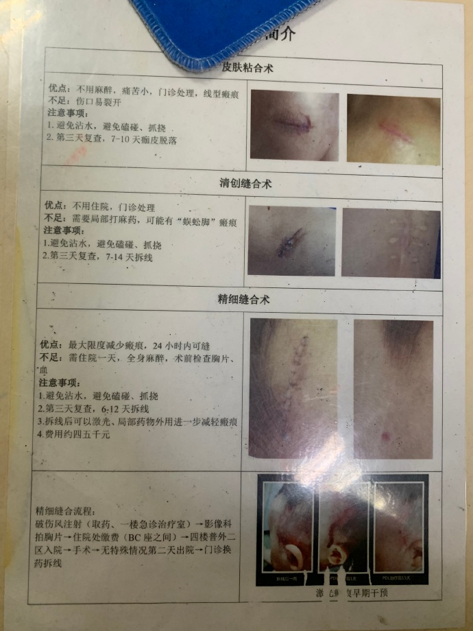 医用凡士林敷料怎么用6岁女童在小区摸了下竹子，手掌被扎了200根刺！孩子的妈妈用各种“偏方”拔刺：醋泡、用瓶子吸、针挑、胶布粘……手掌差点报废_https://www.jmylbn.com_新闻资讯_第24张