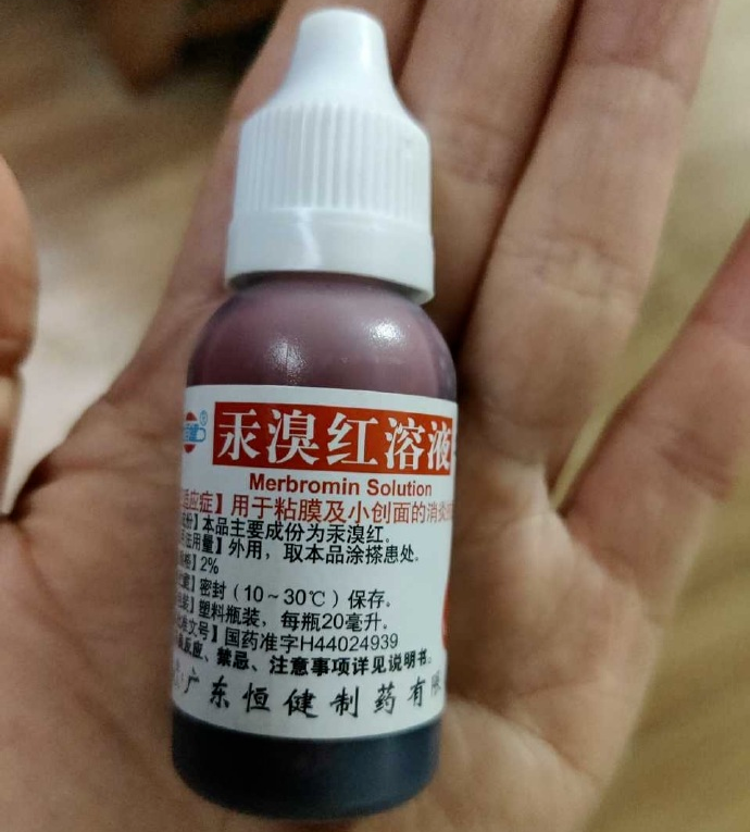 医用凡士林敷料怎么用6岁女童在小区摸了下竹子，手掌被扎了200根刺！孩子的妈妈用各种“偏方”拔刺：醋泡、用瓶子吸、针挑、胶布粘……手掌差点报废_https://www.jmylbn.com_新闻资讯_第49张