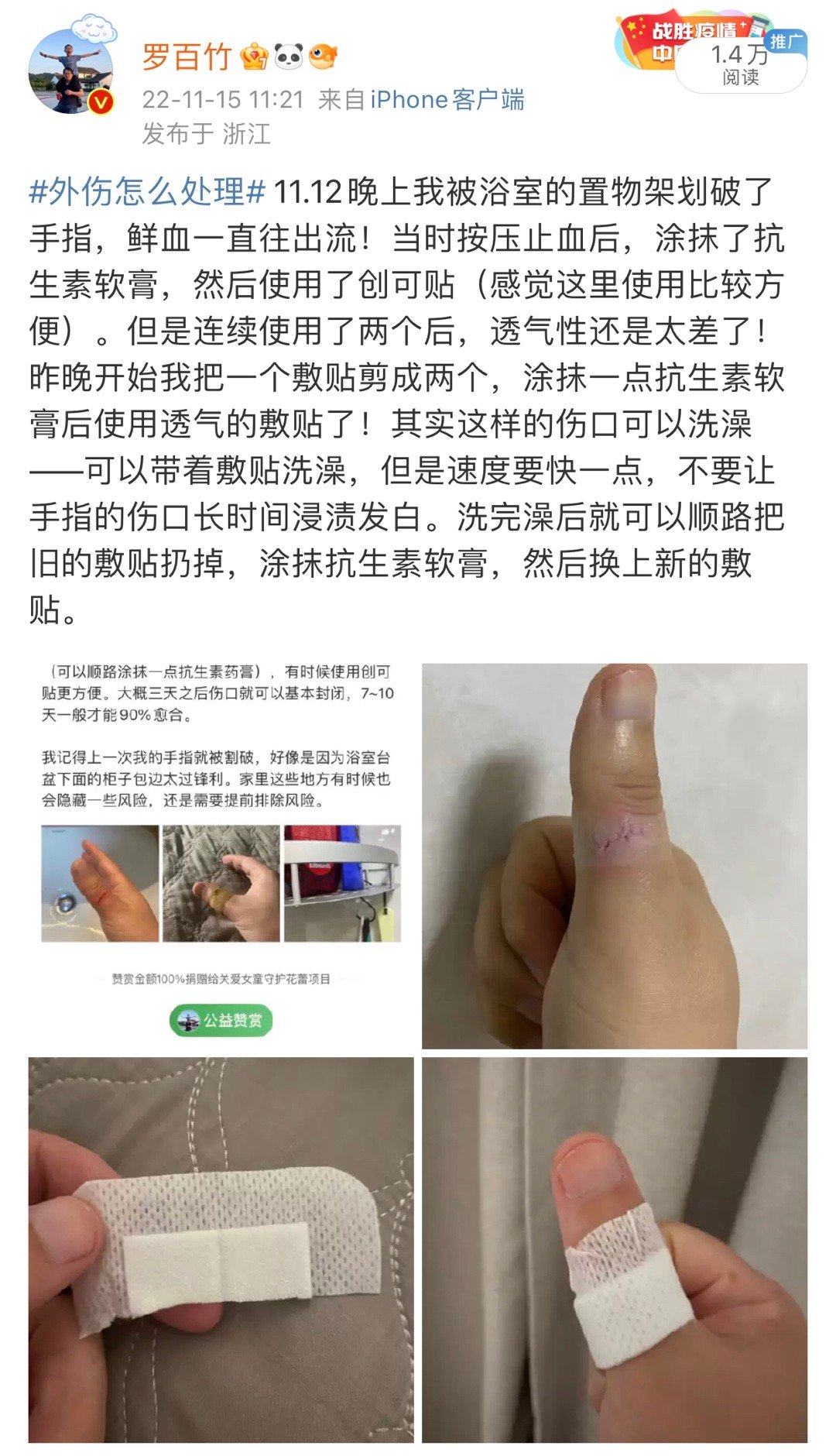 医用凡士林敷料怎么用6岁女童在小区摸了下竹子，手掌被扎了200根刺！孩子的妈妈用各种“偏方”拔刺：醋泡、用瓶子吸、针挑、胶布粘……手掌差点报废_https://www.jmylbn.com_新闻资讯_第85张