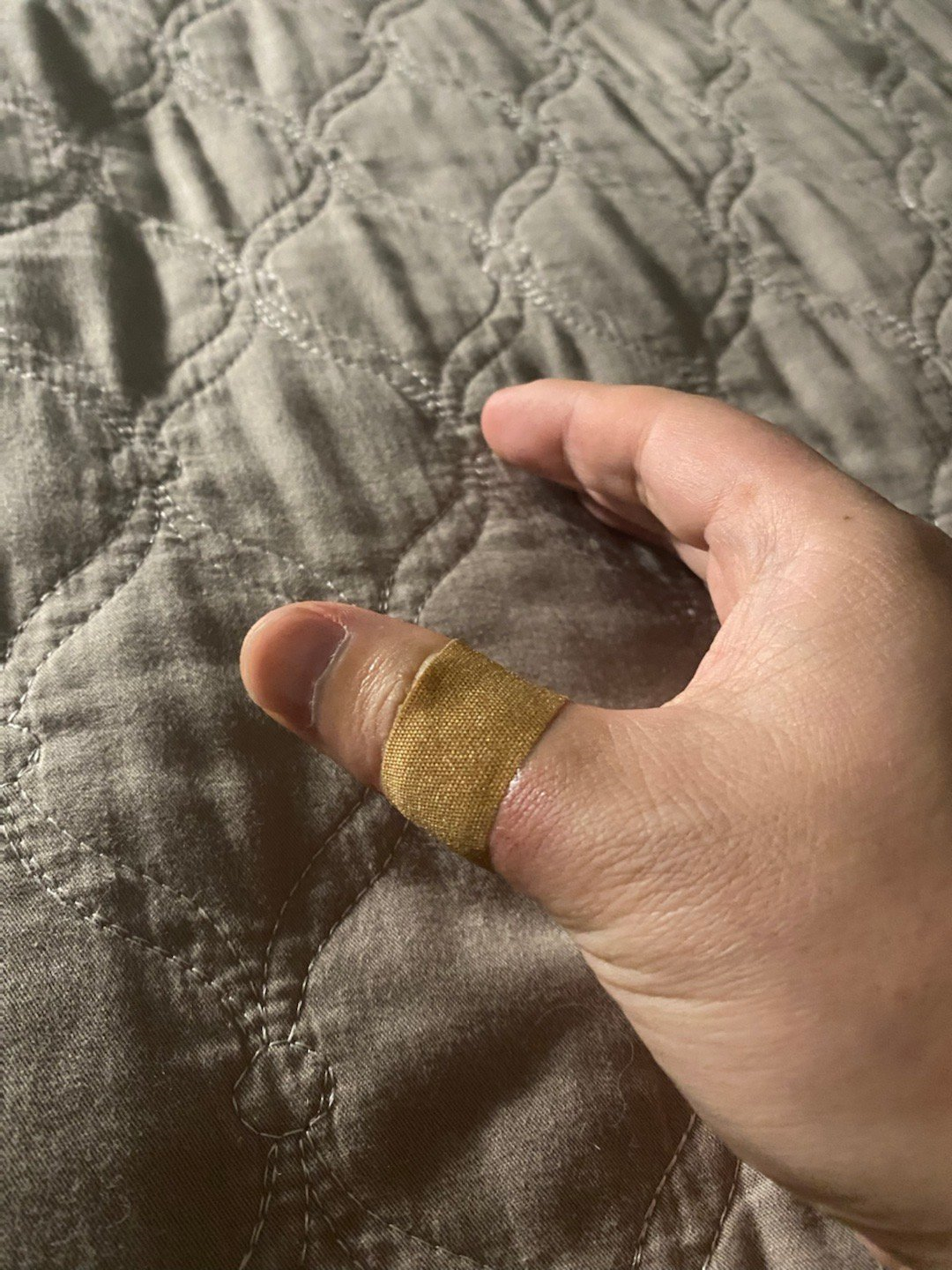 医用凡士林敷料怎么用6岁女童在小区摸了下竹子，手掌被扎了200根刺！孩子的妈妈用各种“偏方”拔刺：醋泡、用瓶子吸、针挑、胶布粘……手掌差点报废_https://www.jmylbn.com_新闻资讯_第12张