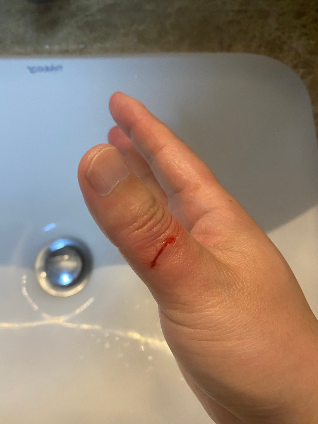 医用凡士林敷料怎么用6岁女童在小区摸了下竹子，手掌被扎了200根刺！孩子的妈妈用各种“偏方”拔刺：醋泡、用瓶子吸、针挑、胶布粘……手掌差点报废_https://www.jmylbn.com_新闻资讯_第11张