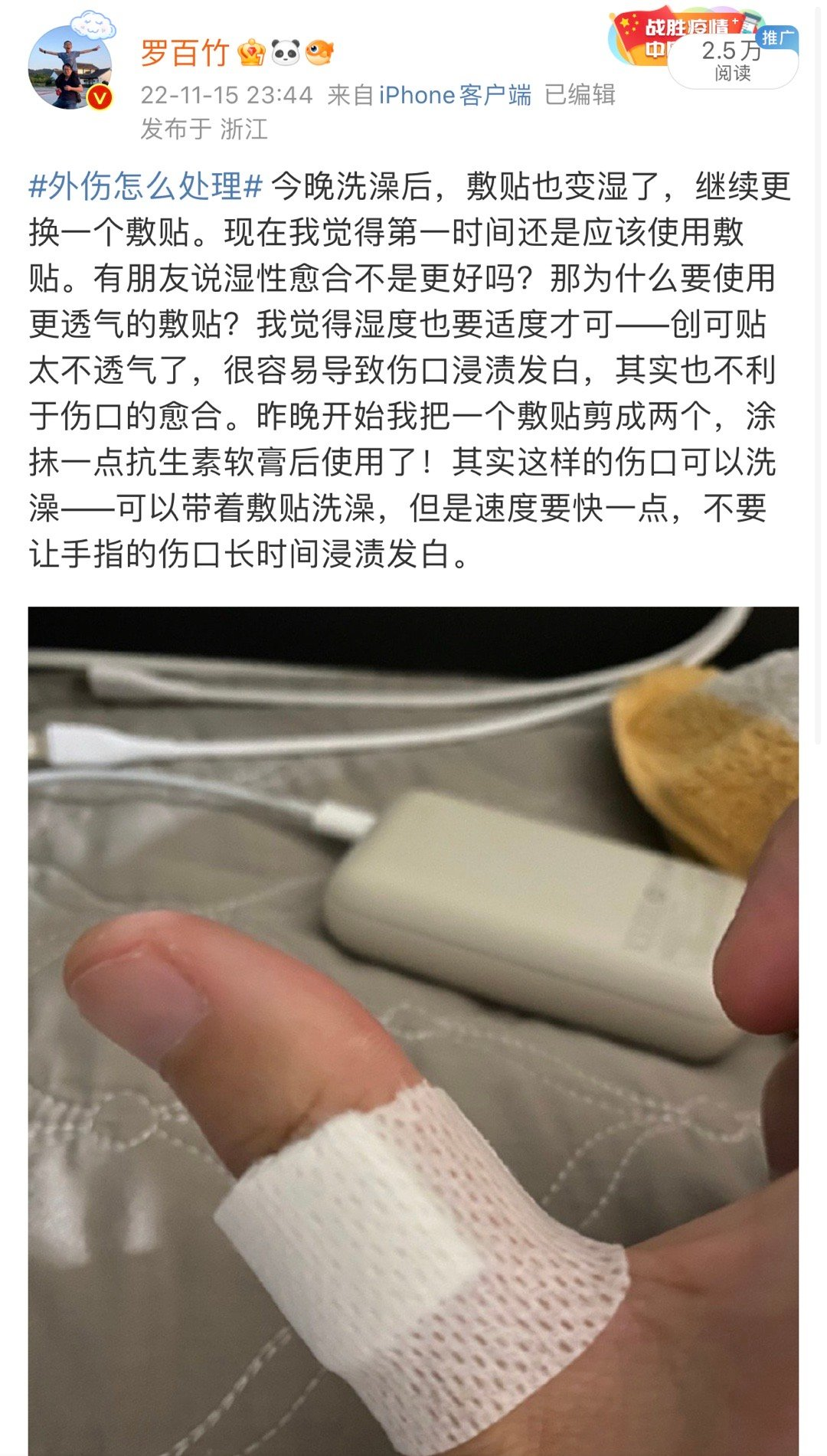 医用凡士林敷料怎么用6岁女童在小区摸了下竹子，手掌被扎了200根刺！孩子的妈妈用各种“偏方”拔刺：醋泡、用瓶子吸、针挑、胶布粘……手掌差点报废_https://www.jmylbn.com_新闻资讯_第86张