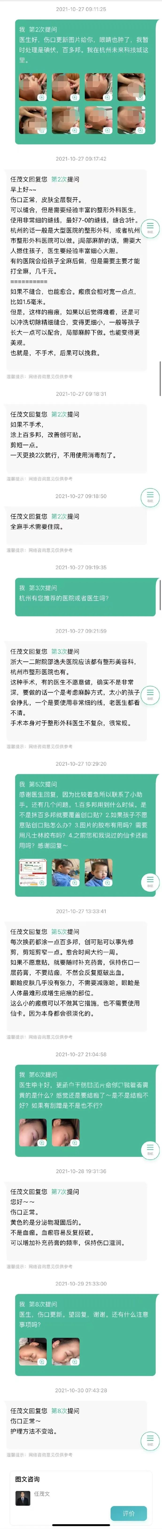 医用凡士林敷料怎么用6岁女童在小区摸了下竹子，手掌被扎了200根刺！孩子的妈妈用各种“偏方”拔刺：醋泡、用瓶子吸、针挑、胶布粘……手掌差点报废_https://www.jmylbn.com_新闻资讯_第20张
