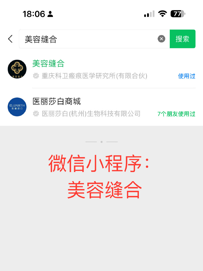 医用凡士林敷料怎么用6岁女童在小区摸了下竹子，手掌被扎了200根刺！孩子的妈妈用各种“偏方”拔刺：醋泡、用瓶子吸、针挑、胶布粘……手掌差点报废_https://www.jmylbn.com_新闻资讯_第39张