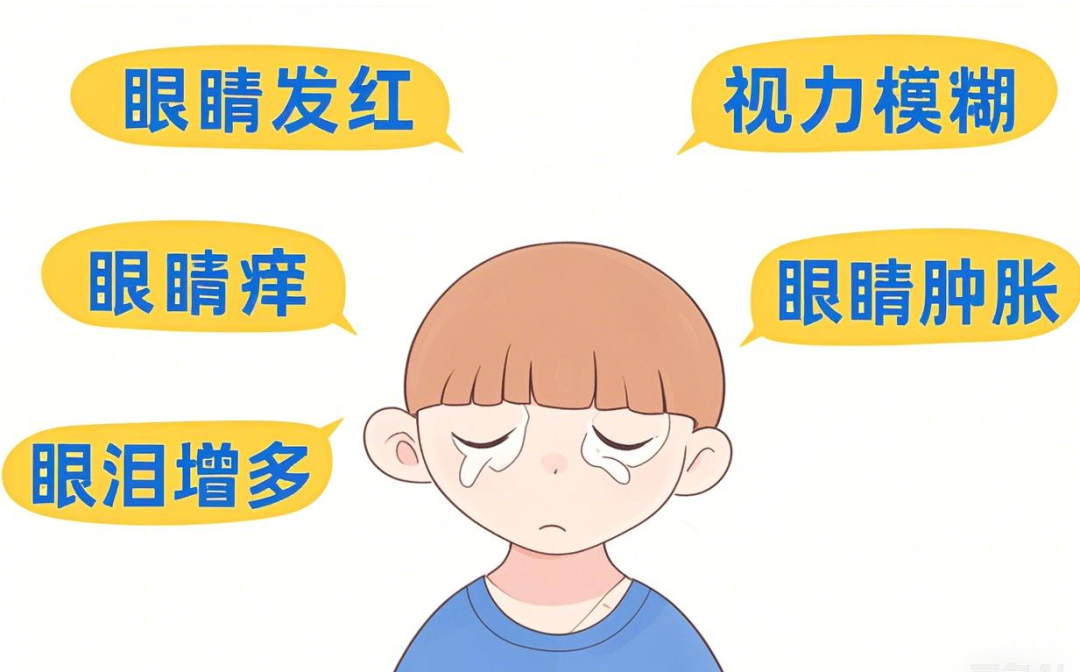 过敏性结膜炎.png