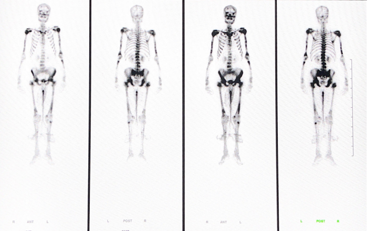 d-spect怎么检查专科分享｜核医学SPECT检查显像的优势及注意事项_https://www.jmylbn.com_新闻资讯_第1张