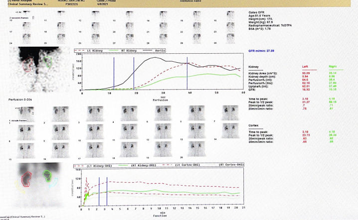 d-spect怎么检查专科分享｜核医学SPECT检查显像的优势及注意事项_https://www.jmylbn.com_新闻资讯_第4张