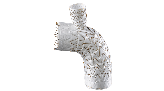 gore医疗怎么样ePTFE或将成为继镍钛合金之后，下一个重塑医疗器械领域的“现象级”材料_https://www.jmylbn.com_新闻资讯_第2张