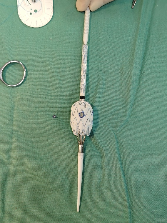 单猪尾支架怎么放【腹具匠新】吴华平教授团队：ENDURANT IIs 分叉支架开窗束径保留 IMA 治疗腹主动脉穿透性溃疡_https://www.jmylbn.com_新闻资讯_第25张