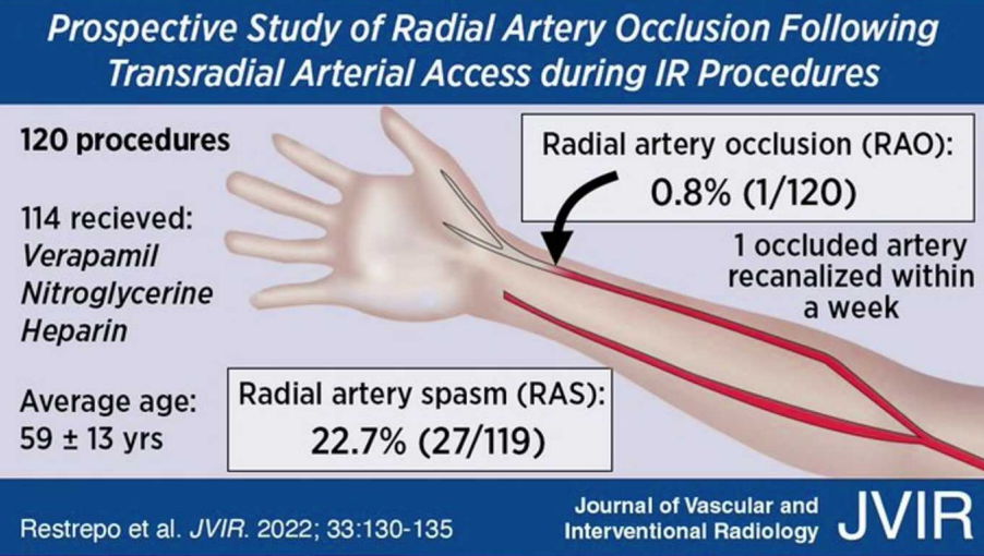 动脉长鞘怎么置入桡胜一筹丨原口拓也：经桡动脉入路在下肢动脉疾病腔内治疗中的优势——RADIANZ应用经验_https://www.jmylbn.com_新闻资讯_第18张