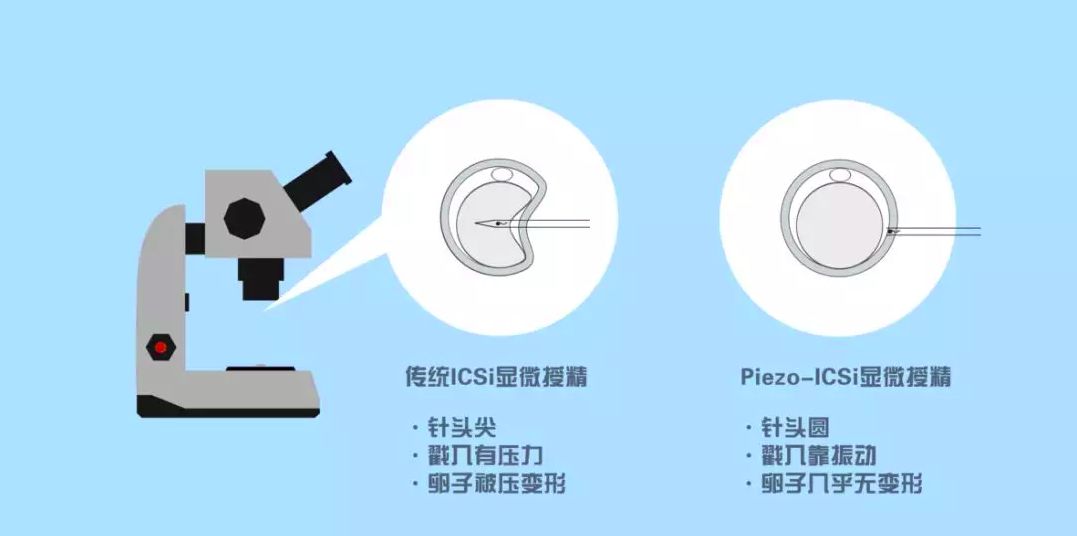 养囊三天看卵子五天看精子_养囊三天和五天的区别_养囊三天成功率多少