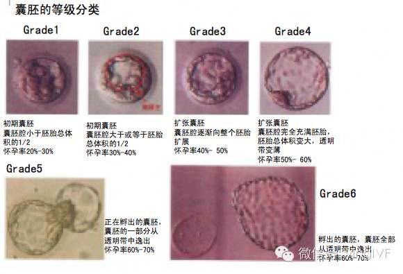 养囊三天看卵子五天看精子_养囊三天和五天的区别_养囊三天成功率多少