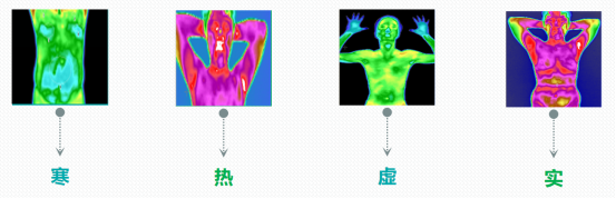 医用红外热像仪怎么开机【特色技术】我院引进红外热像仪，“一眼看穿”你的健康状况！_https://www.jmylbn.com_新闻资讯_第5张