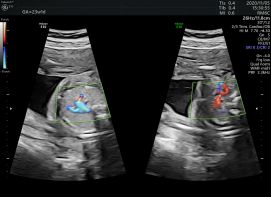 VOlusonE什么彩超机世界顶级四维彩超机美国 GE Voluson E10 BT20金标版落户吉林省吉林中西医结合医院_https://www.jmylbn.com_新闻资讯_第14张