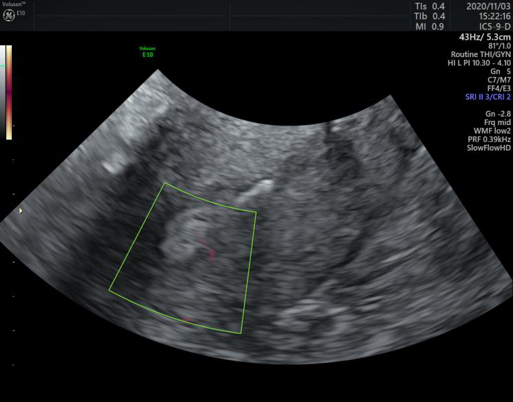 VOlusonE什么彩超机世界顶级四维彩超机美国 GE Voluson E10 BT20金标版落户吉林省吉林中西医结合医院_https://www.jmylbn.com_新闻资讯_第10张