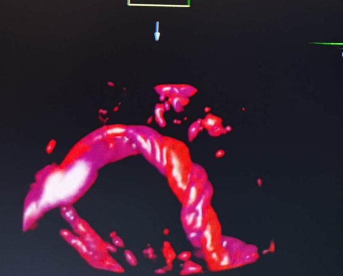 VOlusonE什么彩超机世界顶级四维彩超机美国 GE Voluson E10 BT20金标版落户吉林省吉林中西医结合医院_https://www.jmylbn.com_新闻资讯_第16张