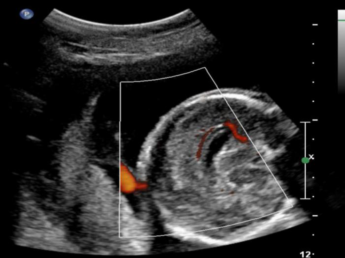 VOlusonE什么彩超机世界顶级四维彩超机美国 GE Voluson E10 BT20金标版落户吉林省吉林中西医结合医院_https://www.jmylbn.com_新闻资讯_第12张