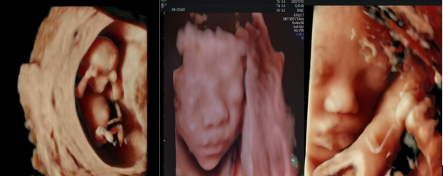 VOlusonE什么彩超机世界顶级四维彩超机美国 GE Voluson E10 BT20金标版落户吉林省吉林中西医结合医院_https://www.jmylbn.com_新闻资讯_第8张