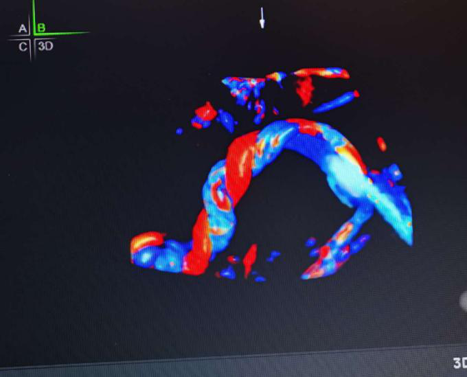 VOlusonE什么彩超机世界顶级四维彩超机美国 GE Voluson E10 BT20金标版落户吉林省吉林中西医结合医院_https://www.jmylbn.com_新闻资讯_第15张