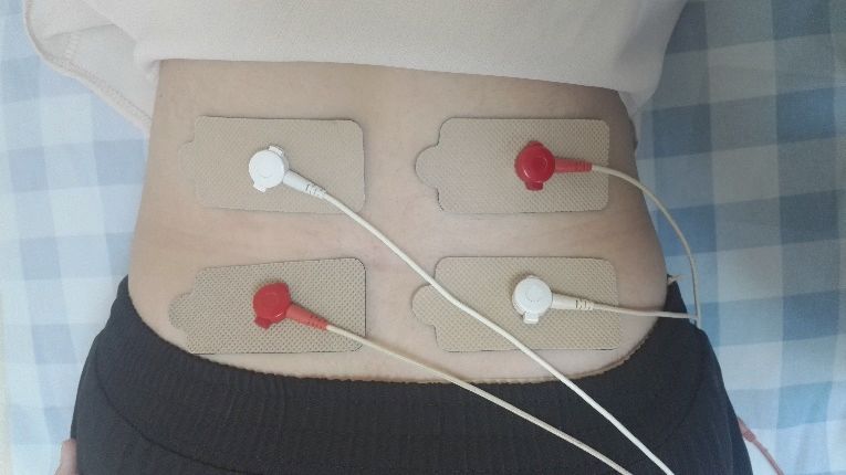 中频为什么能镇痛【干货】中频电疗(Medium Frequency)_https://www.jmylbn.com_新闻资讯_第27张