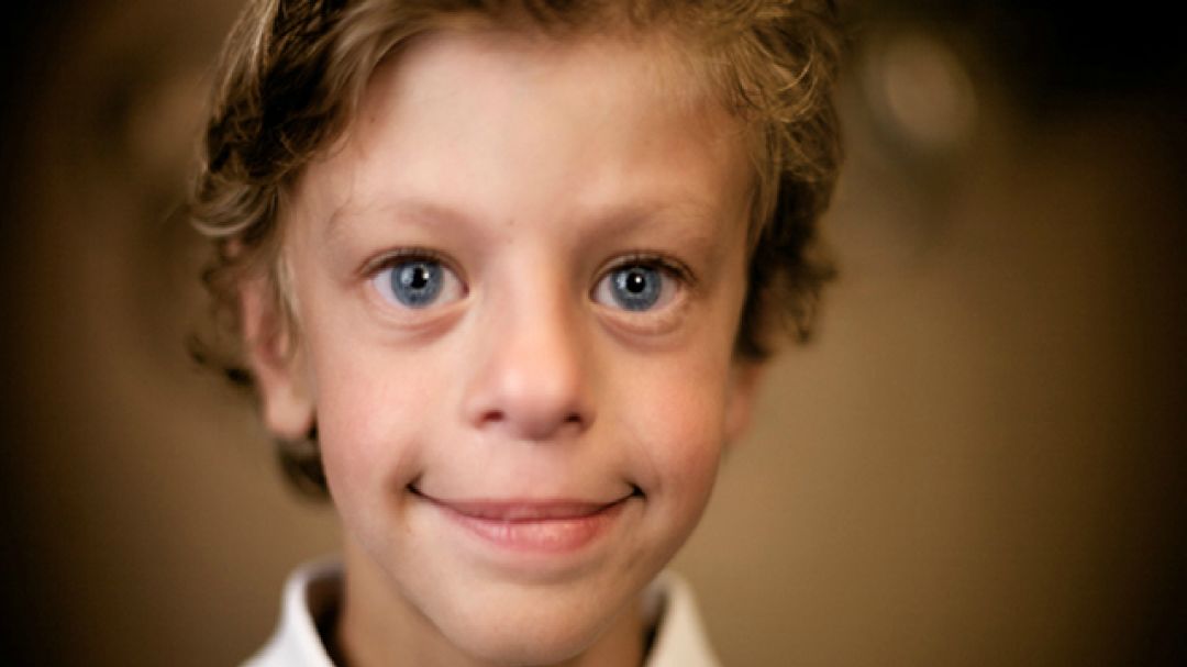 nat neurosci | 冯国平/何志刚合作探索威廉综合征发病机制与治疗方法