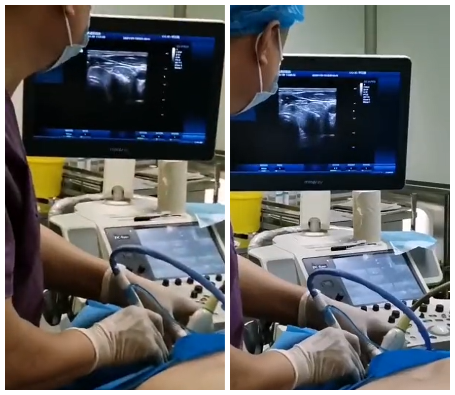 为什么要定位针 乳腺济南中科甲乳医院新一代针孔取瘤术技术大升级_https://www.jmylbn.com_新闻资讯_第5张