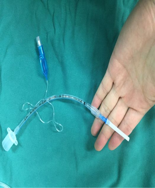 ue可视喉镜怎么购买美容麻醉手册第八季：医美困难气道(陈勇)_https://www.jmylbn.com_新闻资讯_第10张