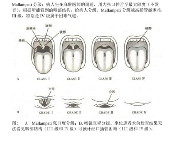 ue可视喉镜怎么购买美容麻醉手册第八季：医美困难气道(陈勇)_https://www.jmylbn.com_新闻资讯_第4张