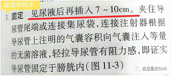 为什么会用一次性导尿包竹海生物一次性使用硅胶导尿管（无痛型）解密留置导尿期间的5大问题_https://www.jmylbn.com_新闻资讯_第4张