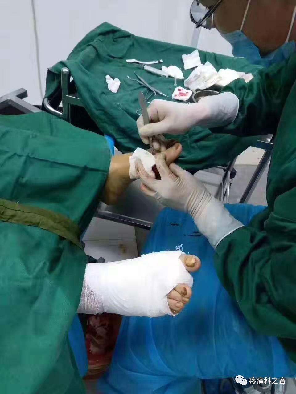 医用磨钻什么牌子好微创拇外翻专用设备-医用电动磨钻_https://www.jmylbn.com_新闻资讯_第24张