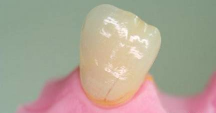 戴牙不就位，支点怎么找？