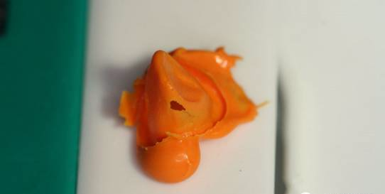 戴牙不就位，支点怎么找？