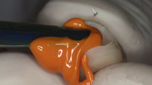 戴牙不就位，支点怎么找？