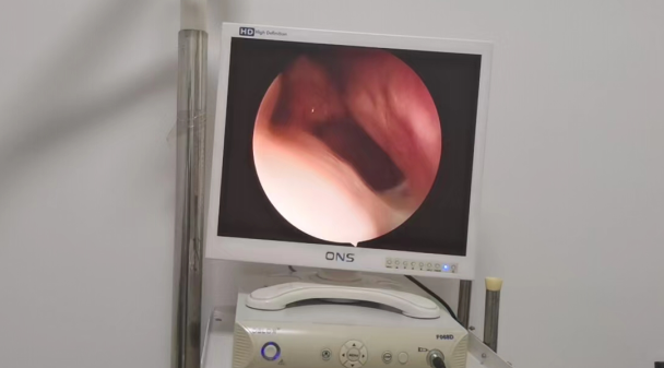 耳鼻喉内窥镜检查是检查什么【红旗科普】耳鼻喉内窥镜 都可以检查哪些疾病？_https://www.jmylbn.com_新闻资讯_第13张