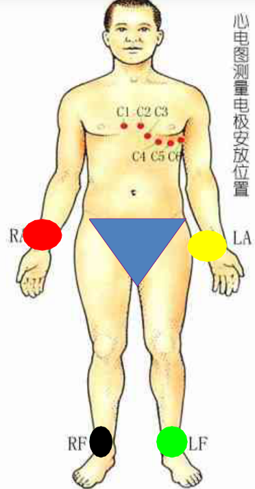 心电图机怎么维护心电图机的分类及维护保养_https://www.jmylbn.com_新闻资讯_第12张