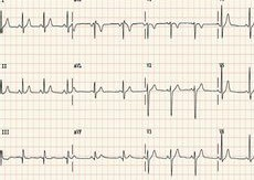 心电图机怎么维护心电图机的分类及维护保养_https://www.jmylbn.com_新闻资讯_第8张