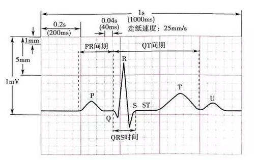 心电图机怎么维护心电图机的分类及维护保养_https://www.jmylbn.com_新闻资讯_第7张
