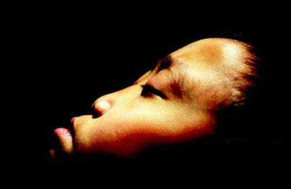 你的鼻子在颜值上占据70%的地位 -解芳副主任医师-爱问医生