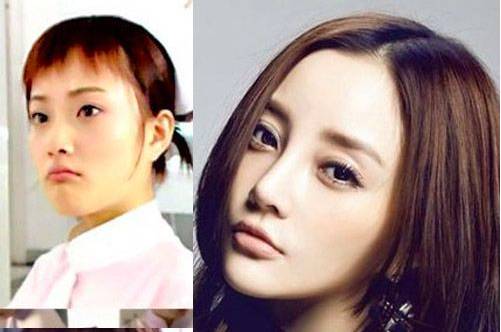 其实,女神王菲的鼻子也算轻度马鞍鼻哦……女神这些年在微整形上花费