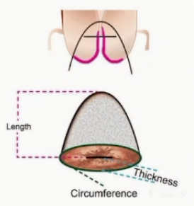 宫颈活检取样怎么取每周一课第14期精彩分享｜杨勇霞教授：绝经后宫颈筛查及异常结果管理相关问题探讨_https://www.jmylbn.com_新闻资讯_第16张
