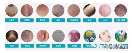 三氧疗法怎么代理德国三氧（O3）大自血疗法：能显著降脂软化血管疏通循环_https://www.jmylbn.com_新闻资讯_第7张