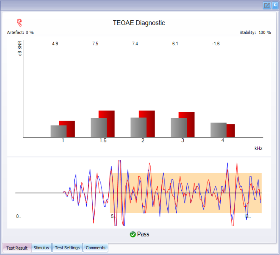 耳声发射图怎么看博闻 ｜ 耳声发射速看速会！_https://www.jmylbn.com_新闻资讯_第16张