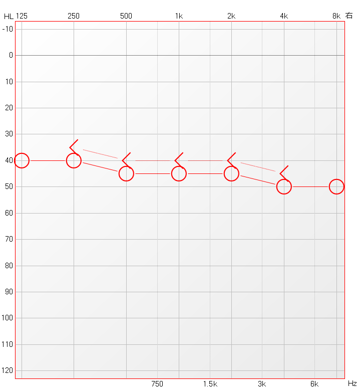 博闻 | 熬夜后耳鸣、听不清？警惕突发性耳聋！(图12)