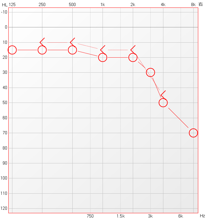 博闻 | 熬夜后耳鸣、听不清？警惕突发性耳聋！(图11)